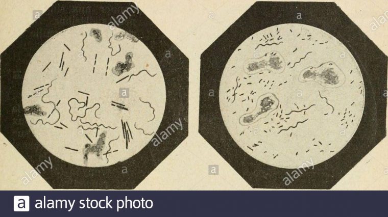 Traité Pratique De Bactériologie . Spirille De La Balanite tout Association De Formes