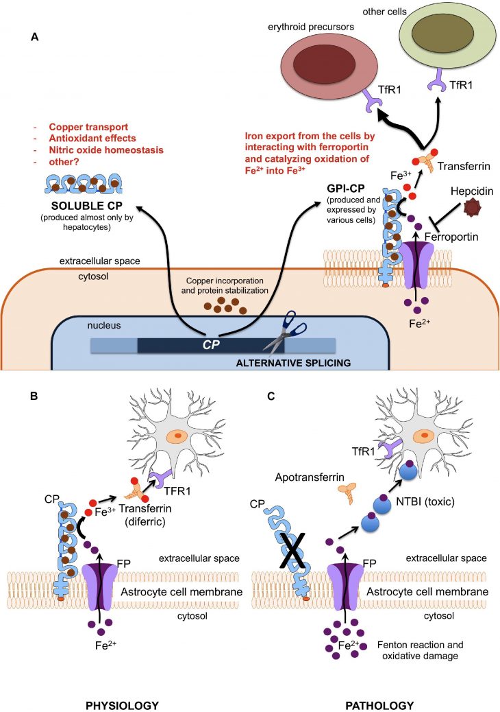 Frontiers | Aceruloplasminemia: A Severe Neurodegenerative pour Reproduction Figure Cp