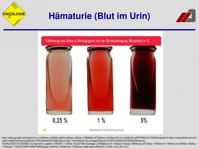 blut im urin erfahrungen