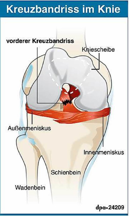 meniskusriss und kreuzbandriss