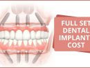 Cost Of Full Set Dental Implant - Center For Implant Dentistry intérieur Same Day Dental Implants Grass Valley, Ca