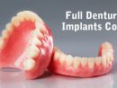 Full Denture Implants Cost - Center For Implant Dentistry pour Same Day Dental Implants Grass Valley, Ca