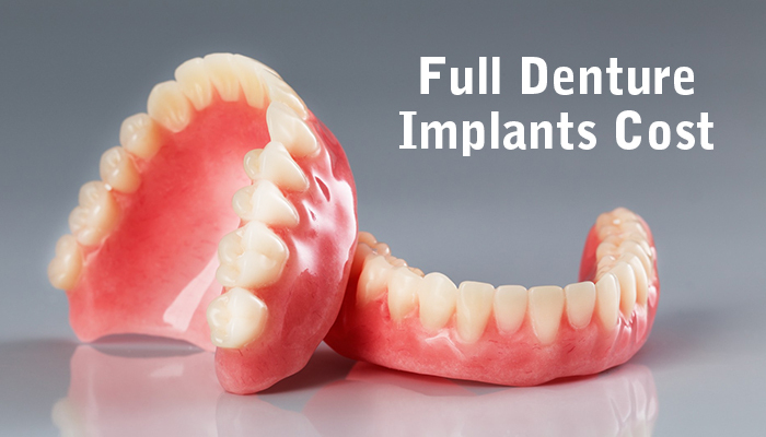 Full Denture Implants Cost - Center For Implant Dentistry pour Same Day Dental Implants Grass Valley, Ca 