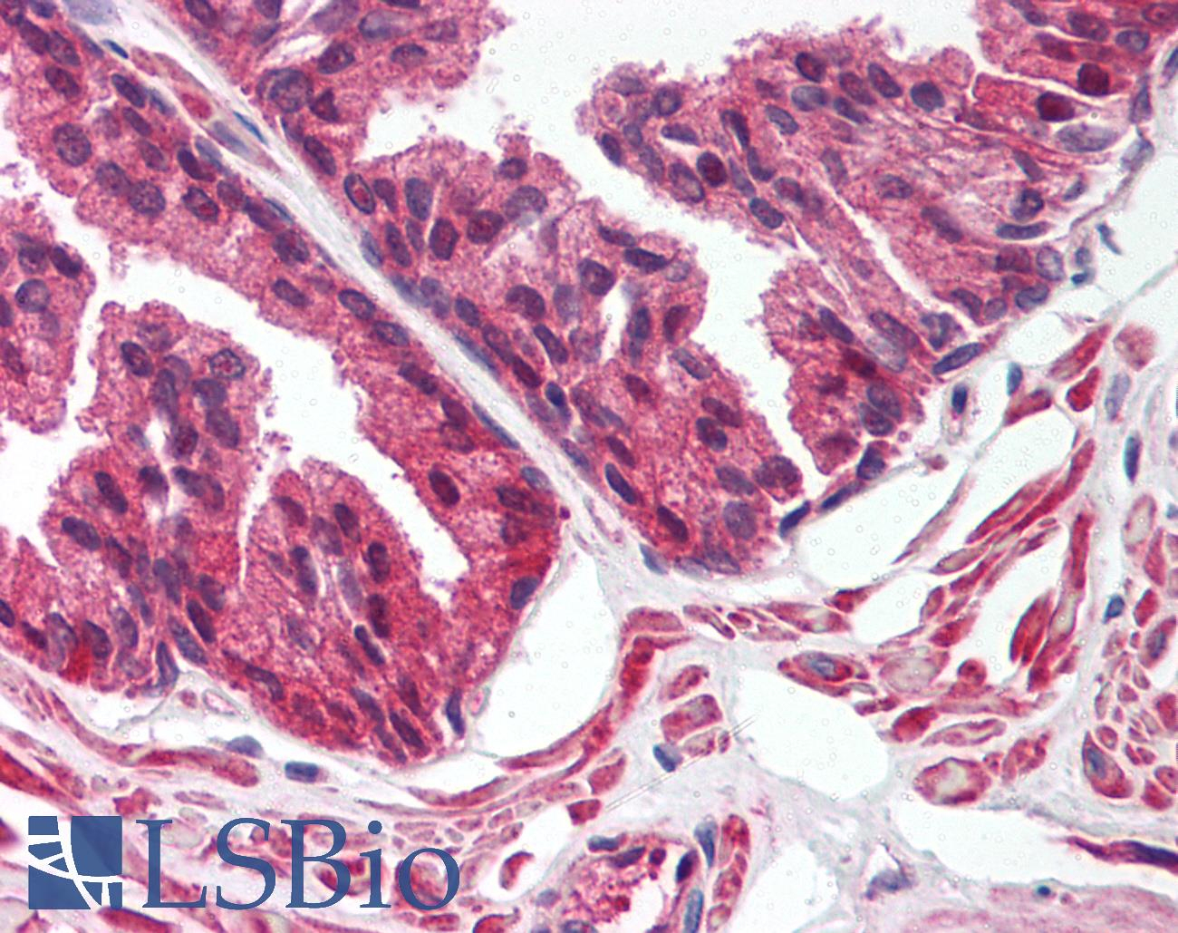 Ihc-Plus™ Alox15B  15-Lox-2 Polyclonal Antibody Rabbit encequiconcerne Lox Antibody 