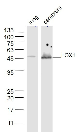 Lox 1 Antibody (Bs-2044R) intérieur Lox Antibody