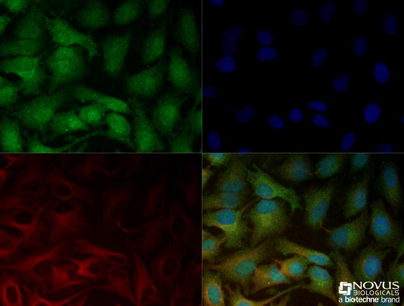 Lox Antibody (Nbp2-24877): Novus Biologicals dedans Lox Antibody