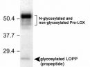 Lox Propeptide Antibody (Nb110-41568): Novus Biologicals tout Lox Antibody