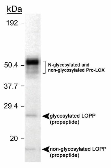 Lox Propeptide Antibody (Nb110-41568): Novus Biologicals tout Lox Antibody 
