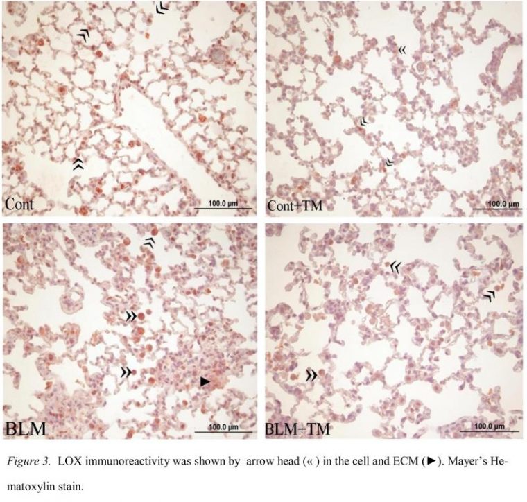 Primary Antibodies: Novus Biologicals destiné Lox Antibody