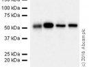 Recombinant Anti-Lox 1 Antibody [Epr20750] (Ab214427)  Abcam tout Lox Antibody