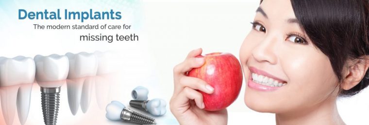 Replace Missing Teeth With A Dental Implant – Silver Smile serapportantà Same Day Dental Implants Grass Valley, Ca