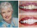 Smile Gallery Of Bradley C Rule Dds  Gurnee Il Dental Office concernant Dental Implants Gurnee Il
