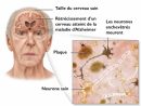 5 Conseils Pour Prévenir La Maladie D'Alzheimer dedans Exercises De Memoire Alzheimer