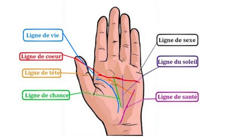 Japon : La Chirurgie Esthétique Peut Changer Votre Ligne De Destin à Ligne Main