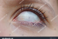 scary blind eyes scary blind eyes